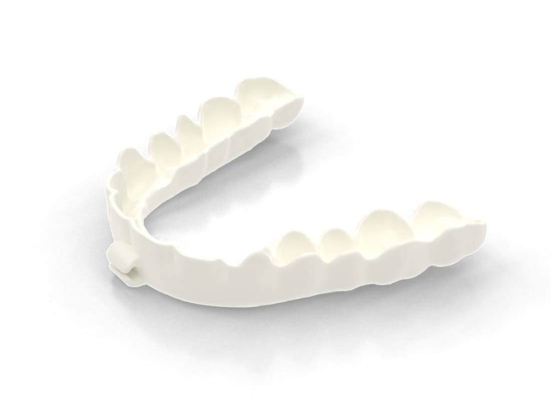 Wat kost 3D printen? - Prijsvoorbeeld: Beugel